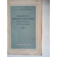 Анкилоз нижнечелюстного сустава и его лечение